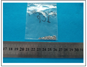 17-4PH不锈钢成分分析